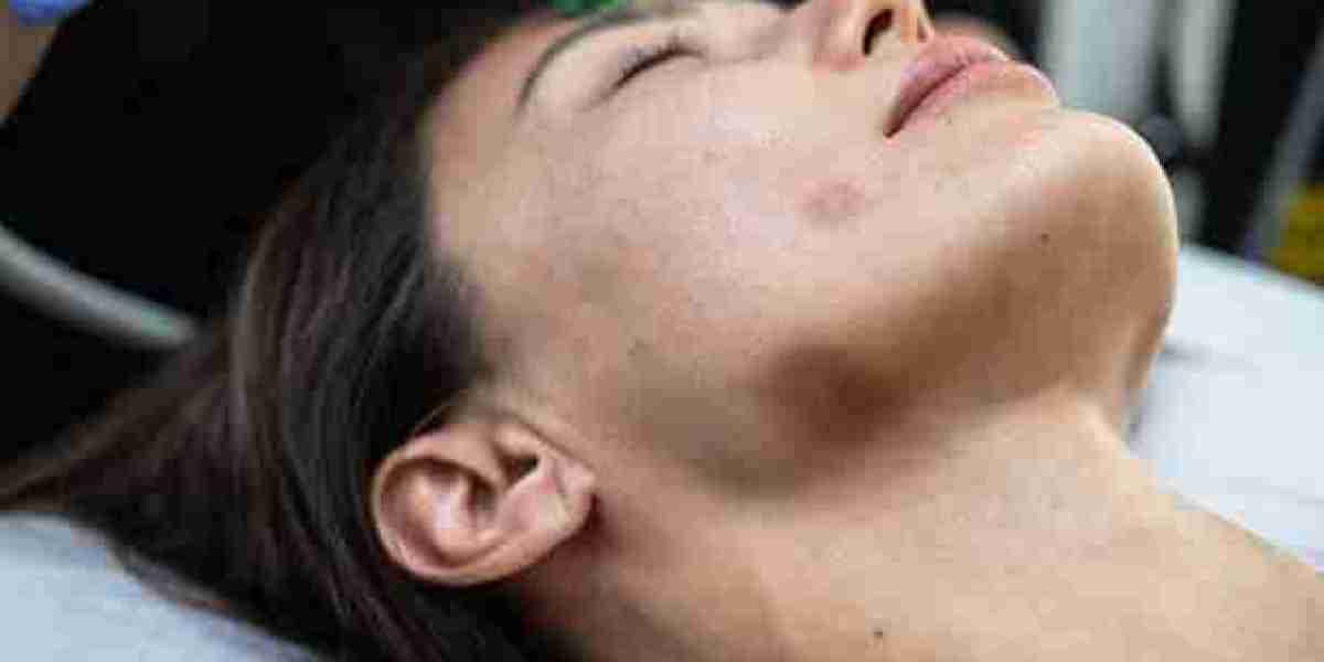 Facial Capillary Treatment in Dubai for Flushing After Spicy Food