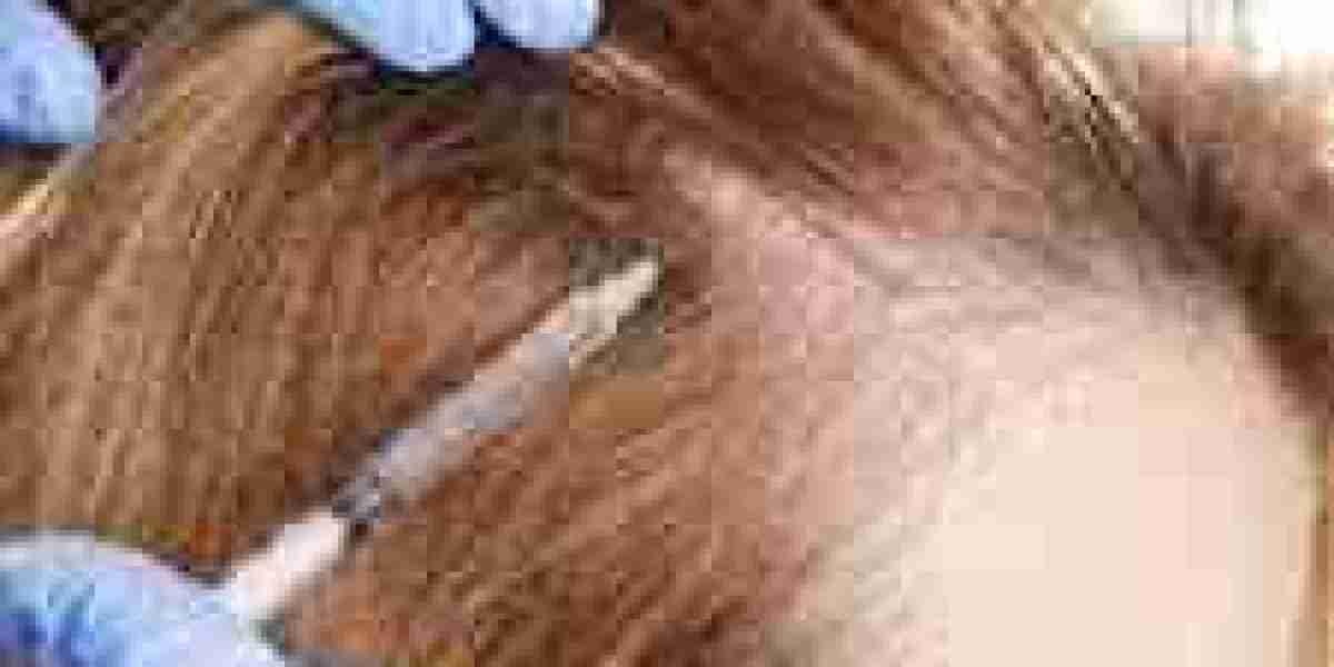 PRP in Dubai for Radiant Skin and Hair Restoration