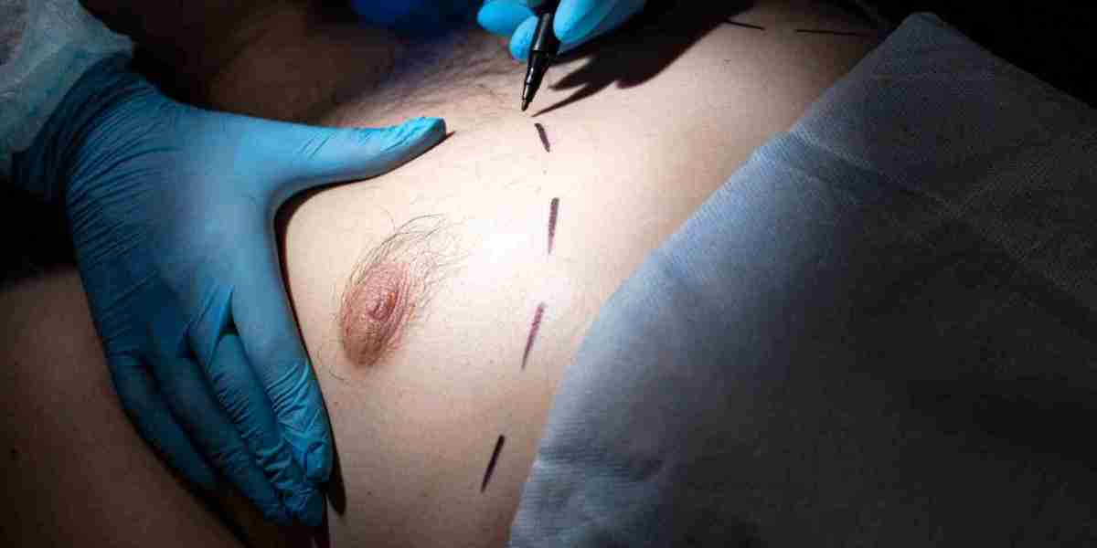 How Surgeons Determine Inverted Nipple Surgery Cost