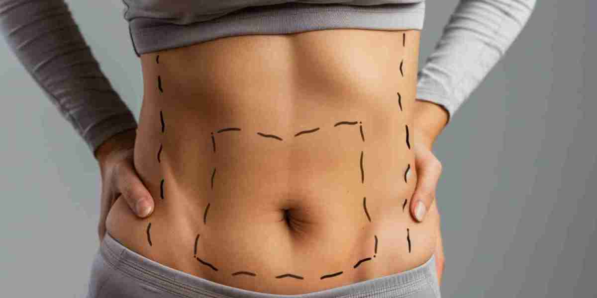 What to Expect Before and After Liposuction in Dubai