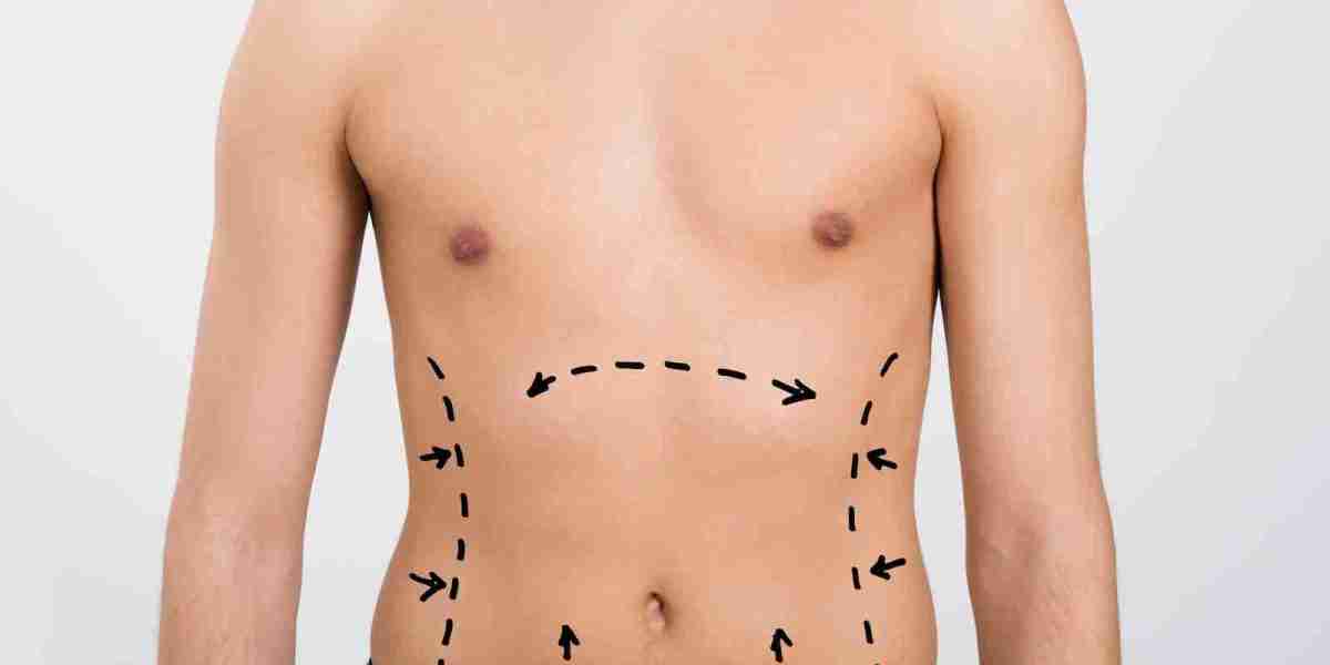 Comparing CoolSculpting and vaser liposuction in Islamabad