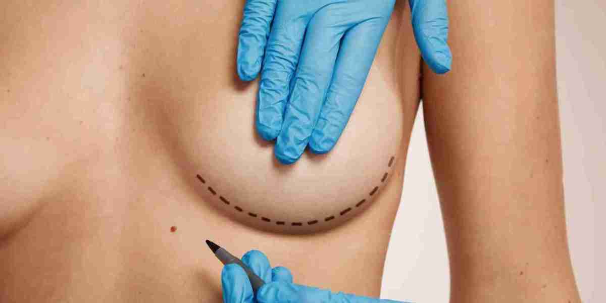 Breast Lift in Dubai Without Implants: Is It Possible?