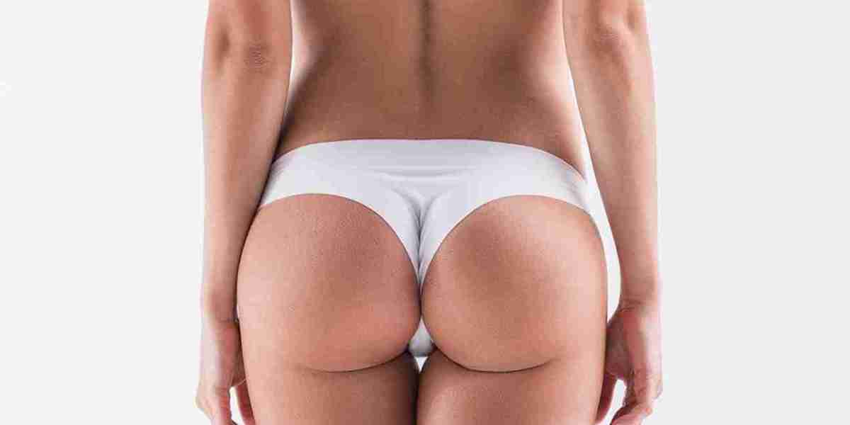 Brazilian Butt Lift and Fat Redistribution Explained