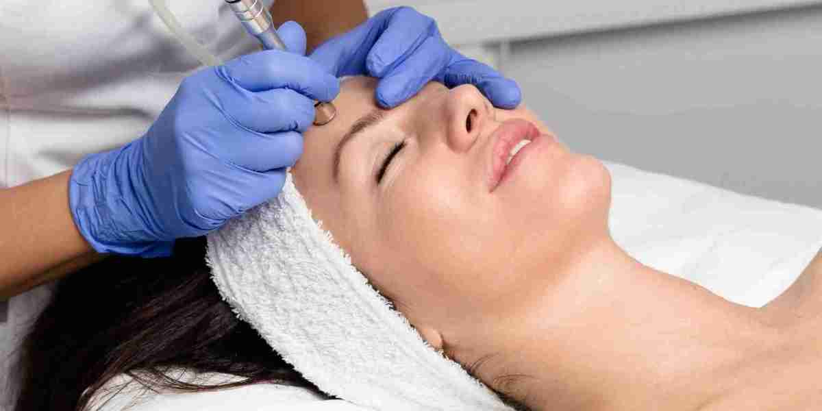Skin Rejuvenation Through Microdermabrasion Sessions