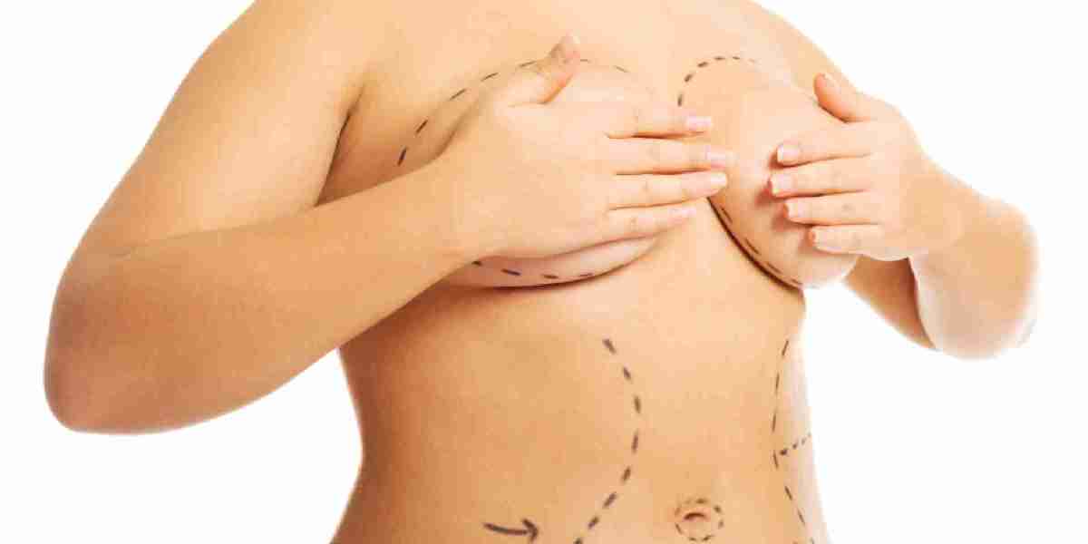 Is Breast Lift the Ideal Way to Achieve Youthful Chest Elevation?