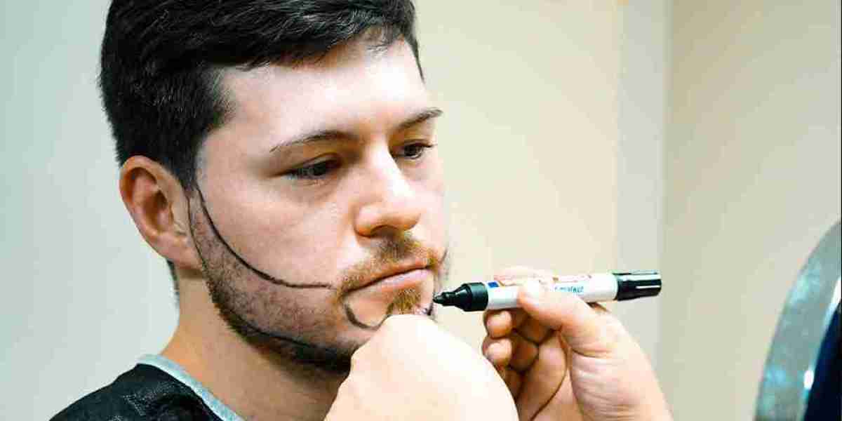 Beard Hair Transplant in Islamabad: Common Myths You Should Stop Believing