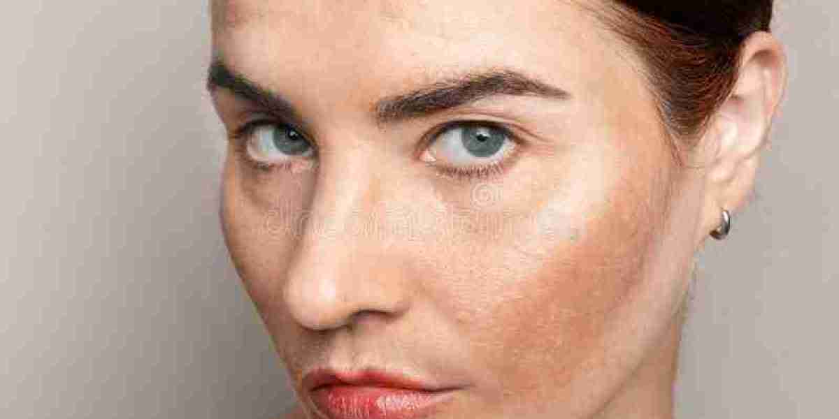 Glow Reset Freckles and Blemishes fade into radiant natural skin glow