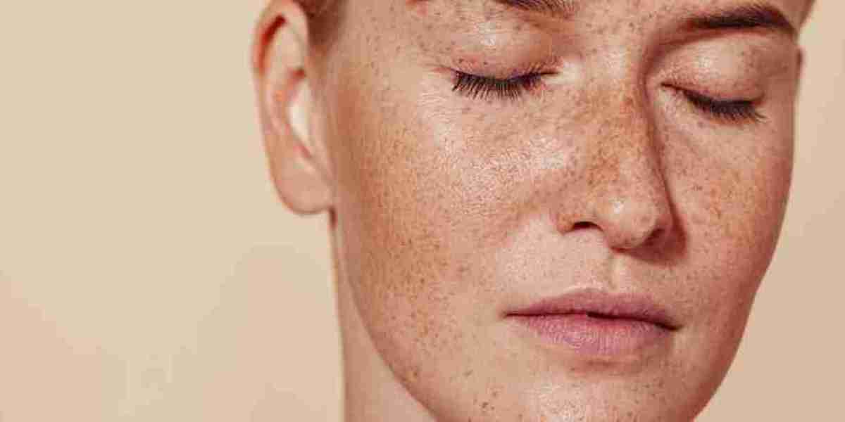 What to Expect During Pigmentation Treatment in Dubai