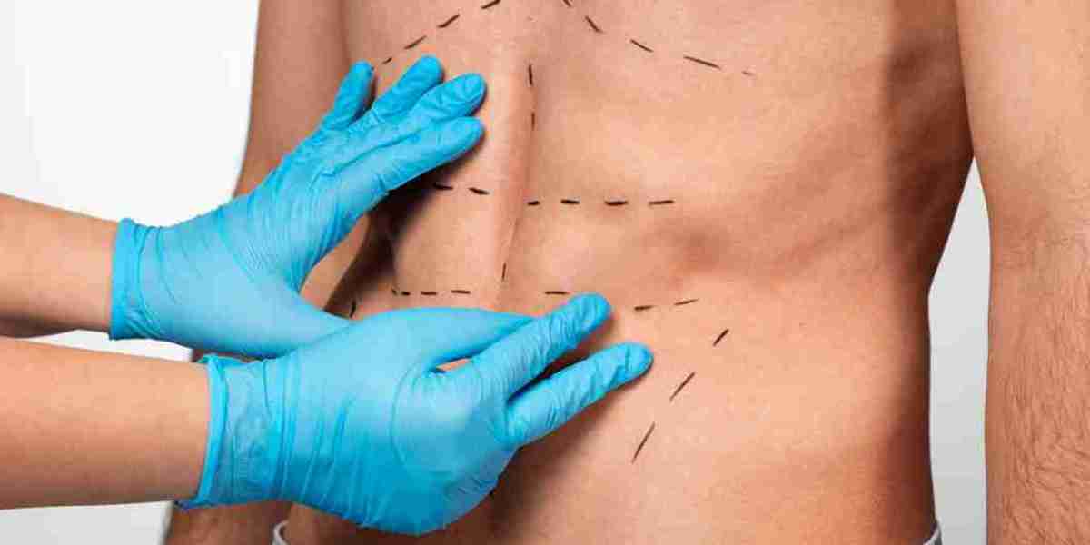 How Liposuction Enhances Body Contouring and Confidence