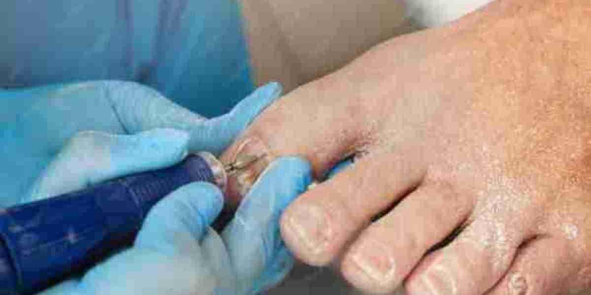 Beyond Treatment: How Diabetic Foot Care Near Me Supports Long-Term Mobility