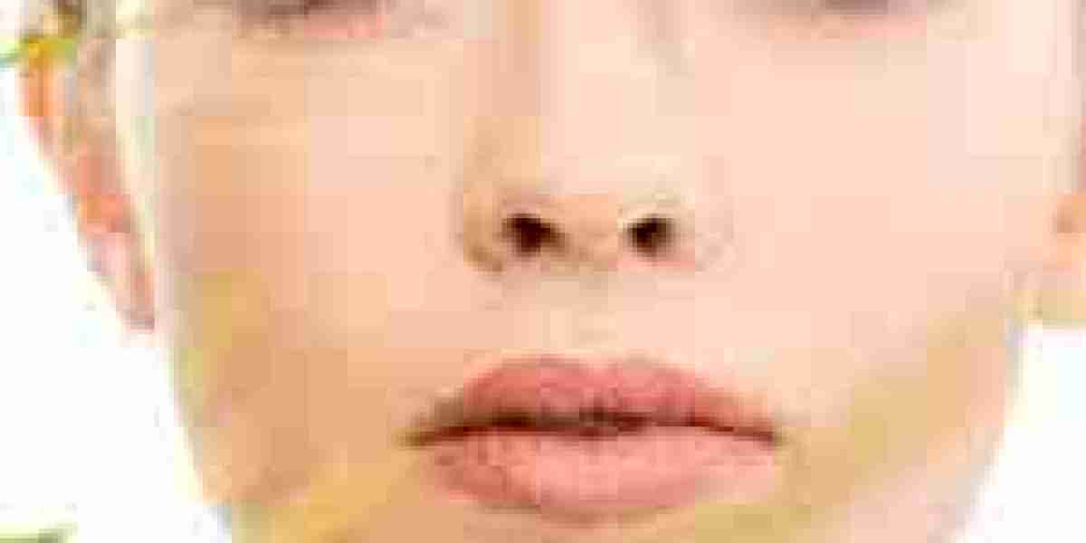 Sculptra in Dubai – Rebuild Collagen for Lasting Results