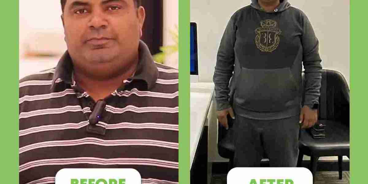 Complete Guide to Choosing the Right Weight Loss Procedure