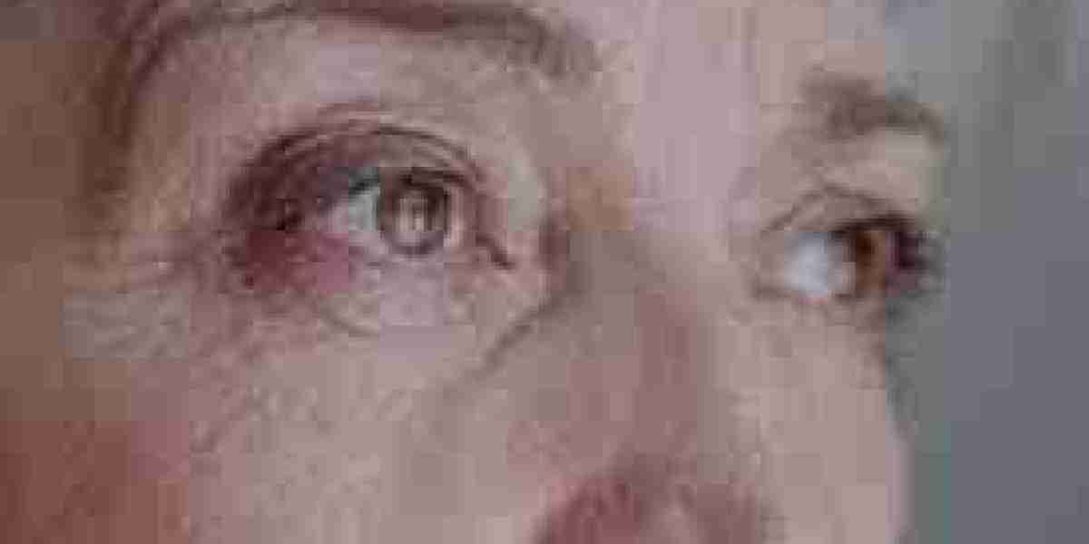 Fine Lines and Wrinkles in Dubai: Signs, Prevention, and Treatment Options
