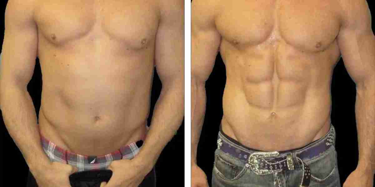 Best Specialists Delivering Six-Pack Abs in Dubai