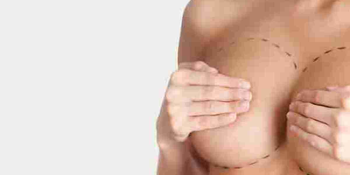 Everything You Need to Know About Breast Surgery in Dubai | Complete Guide