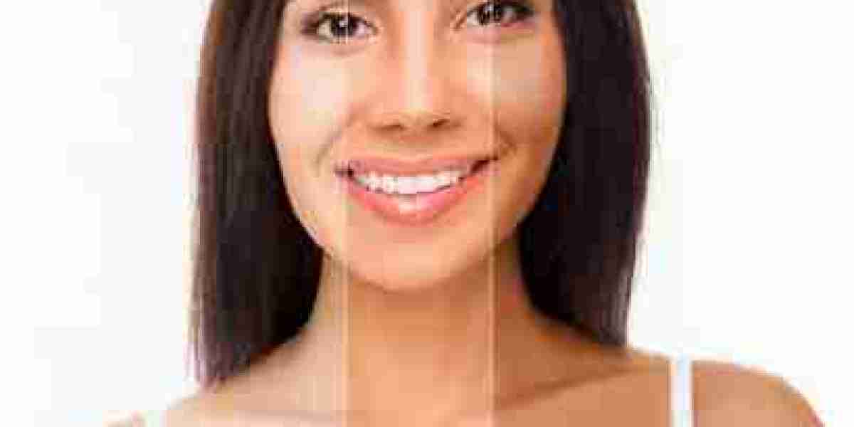 Skin Whitening in Dubai: Modern Pigment Correction