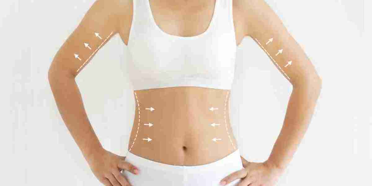 Body Contouring Treatment in Islamabad: The Ultimate Guide for First-Time Patients