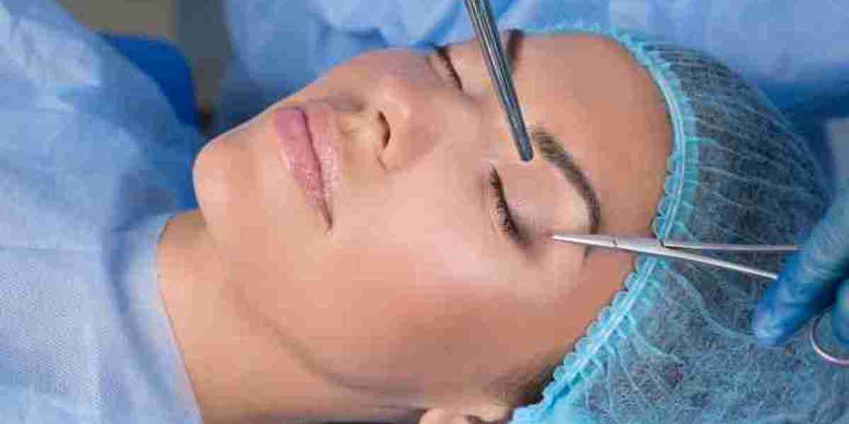Common Myths About Eyelid Surgery in Islamabad You Should Ignore