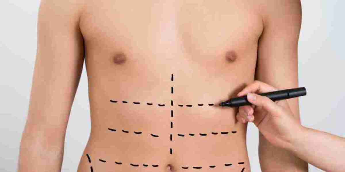 Liposuction in Dubai With Contemporary Fat Reduction