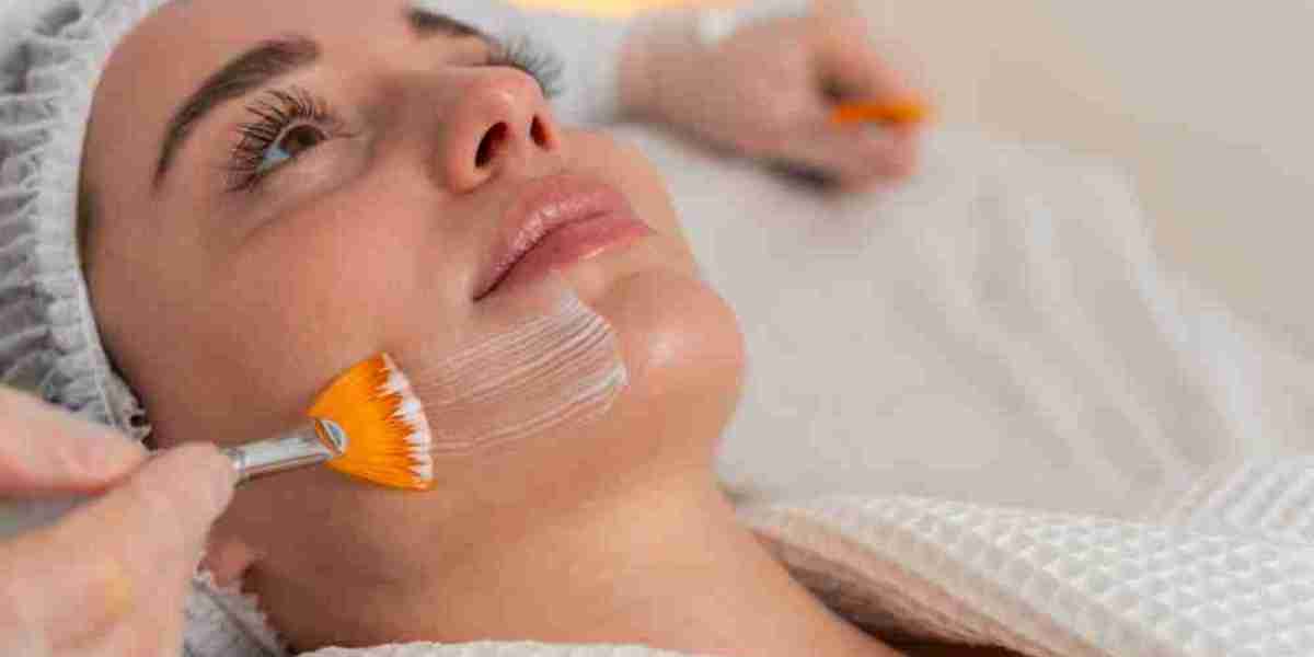 What Makes Chemical Peels in Islamabad a Popular Choice Among Pakistanis?