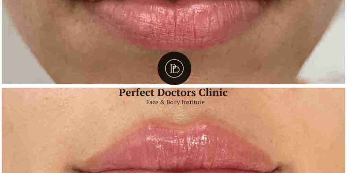 Can Anyone Get Juvederm in Dubai?