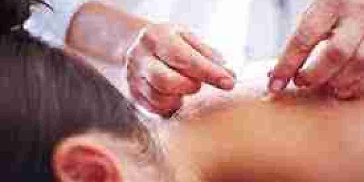 Acupuncture Treatment in Dubai: Traditional Healing for Modern Lifestyles