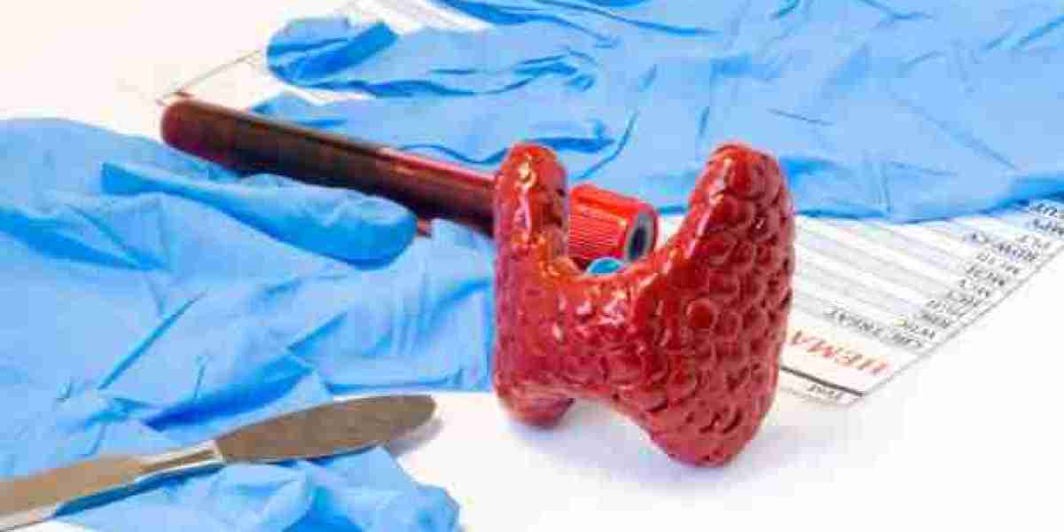 Why Choose Thyroidectomy in Dubai – Expert Care
