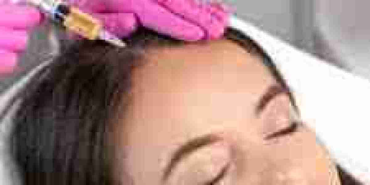 PRP Hair Treatment in Abu Dhabi for Early Hair Thinning | Complete Guide