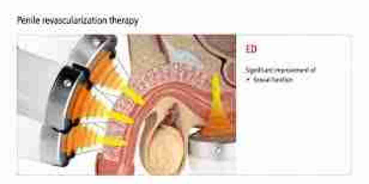 Choosing the Right Erectile Dysfunction Treatment in Dubai | Complete Guide