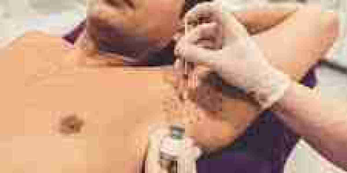 Hyperhidrosis Treatment in Dubai | The Latest Techniques for Sweat Reduction