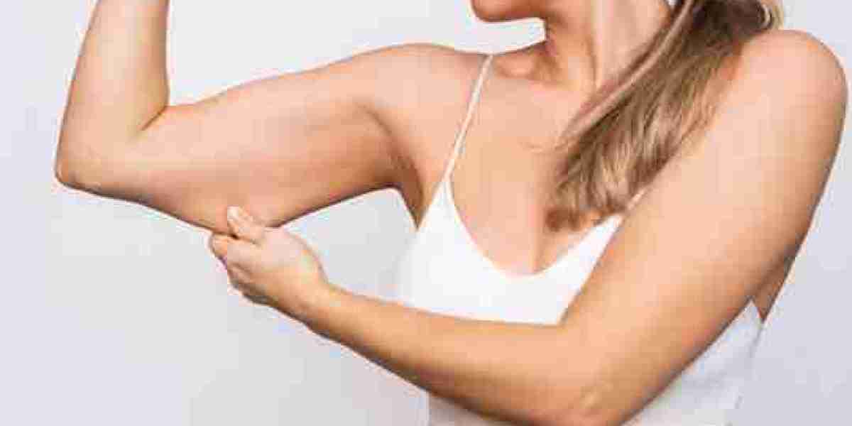 Arm Lift Surgery in Dubai for Toned Arm Contours