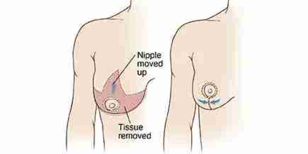 Consult top-rated breast specialist in pune Dr Shilpy