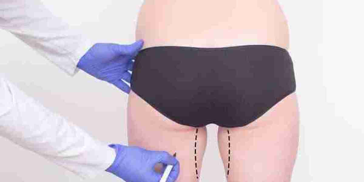 What to Expect Before and After Thigh Lift in Dubai | Complete Guide