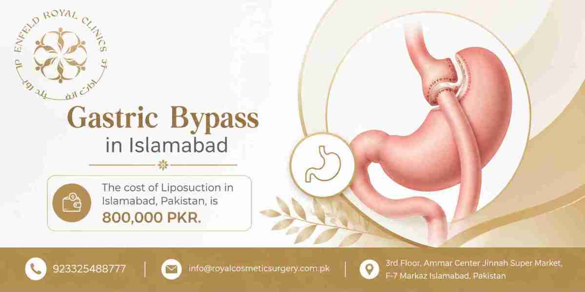 Gastric Bypass and Diabetes Management