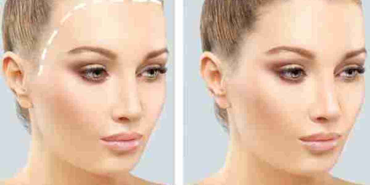 Hair Transplant in Dubai for Thinning Hair | Complete Guide