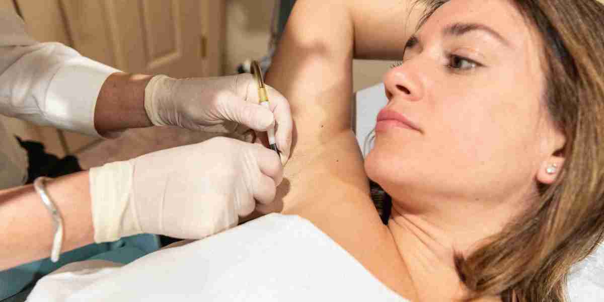 Electrolysis Laser Hair Removal Islamabad: Discover the Benefits of Advanced Hair Removal Technology