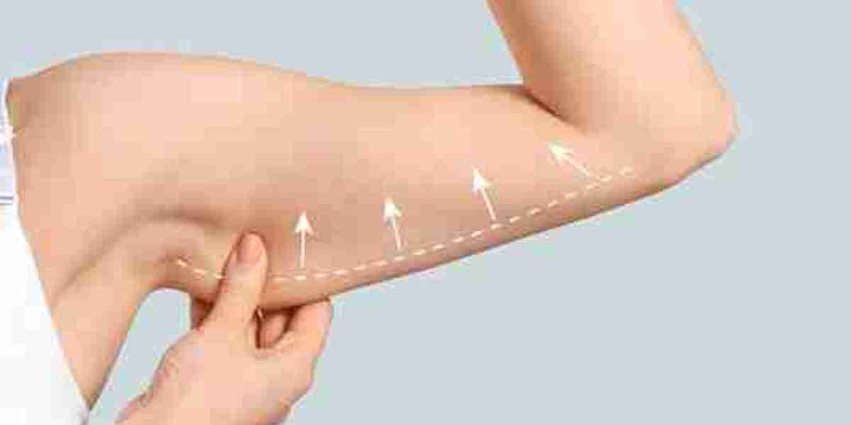Arm Lift Surgery in Dubai: Complete Recovery Guide