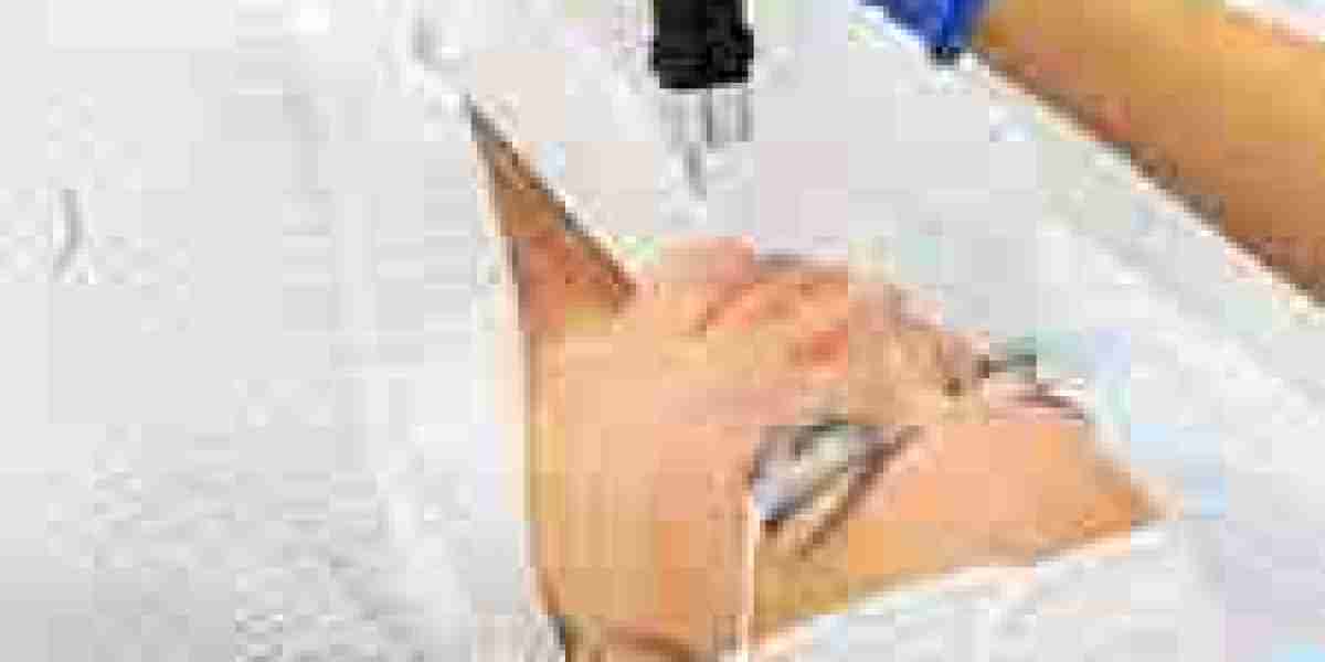 Pico Laser Treatment in Dubai | Advanced Skin Rejuvenation Technology
