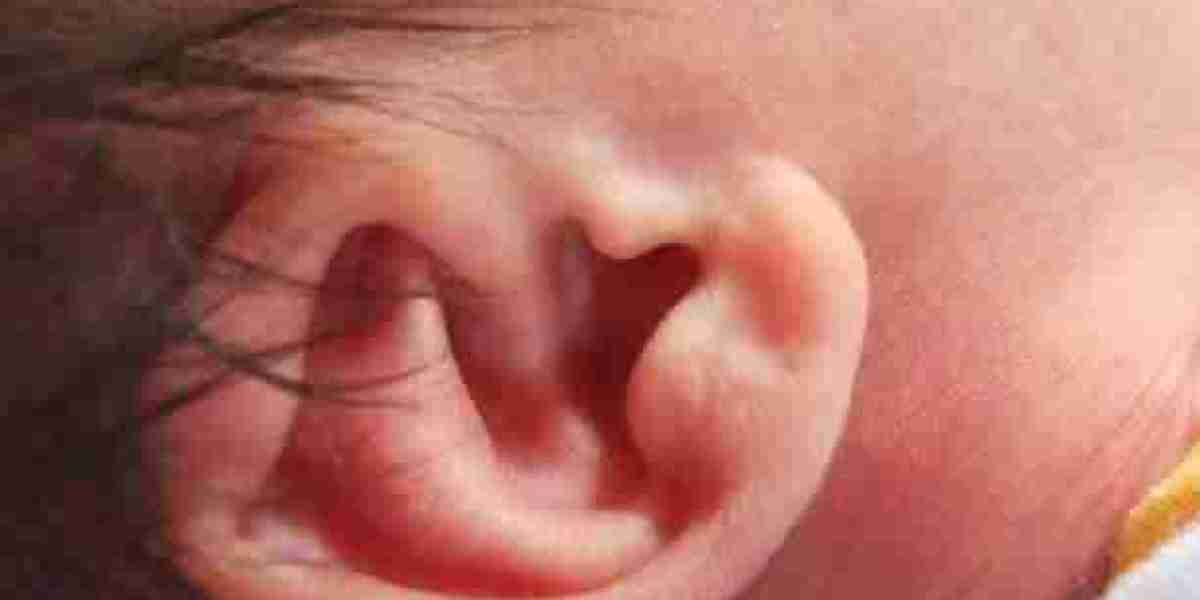 Real-Time Preauricular Tag Removal in Dubai Solution