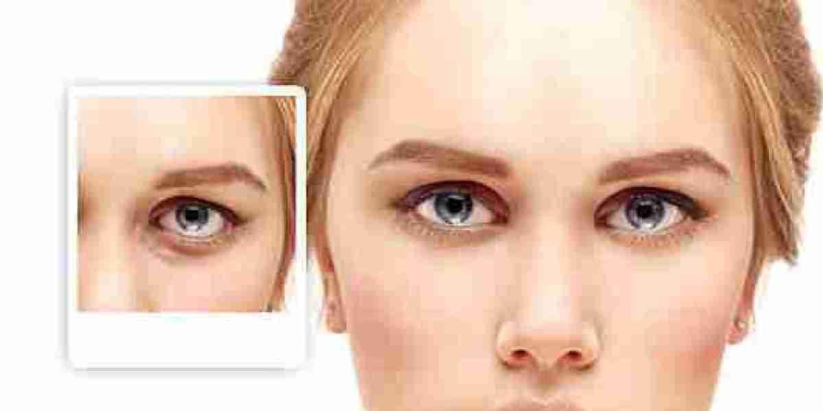 Why Fat Transfer Surgery in Dubai Is Worth Considering