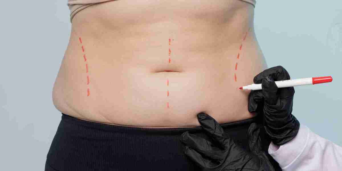 Clinics for Advanced Fat Transfer Surgery in Dubai