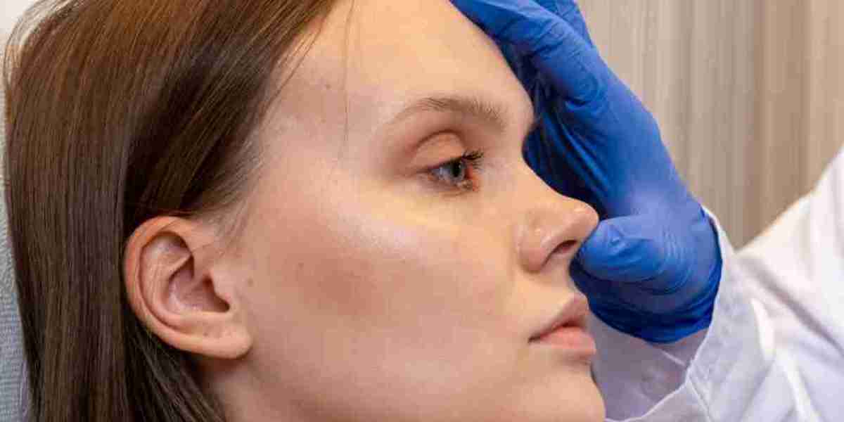 Rhinoplasty in Islamabad: What Makes a Natural-Looking Nose?
