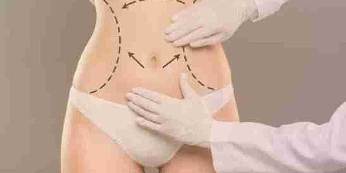 Tummy Tuck in Dubai | Guide to a Smoother Abdominal Profile