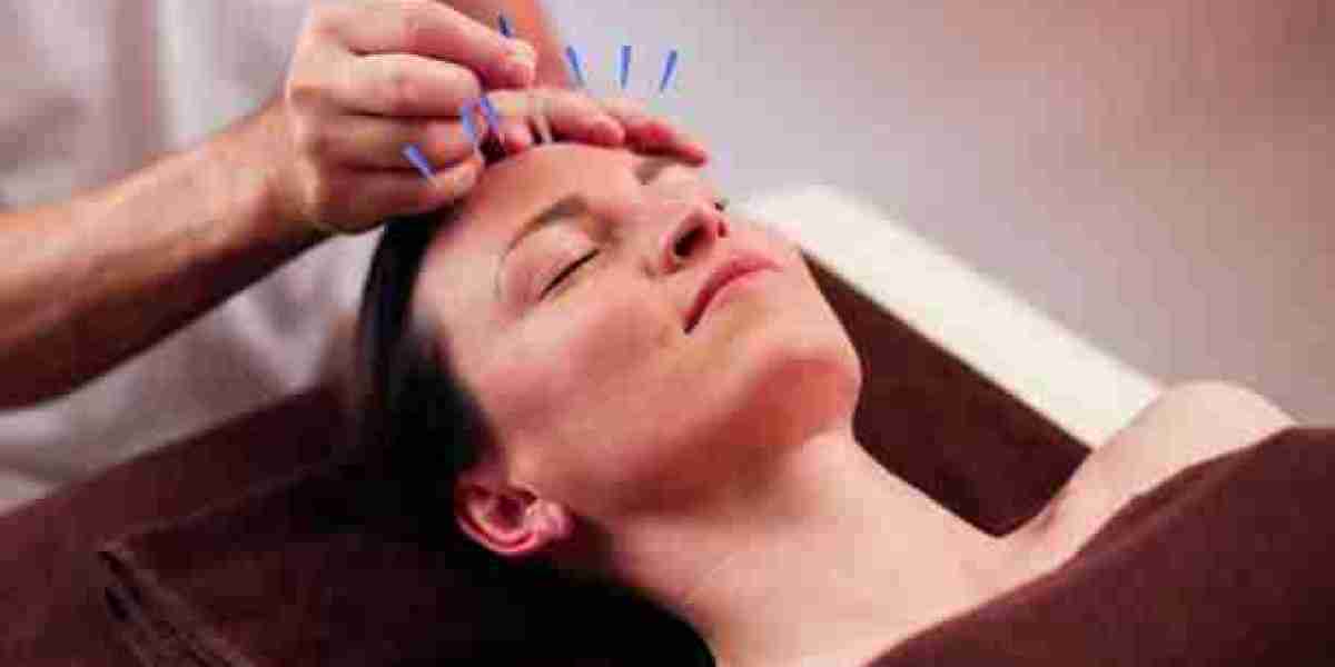 Can Acupuncture Treatment in Dubai Support Pain Management?