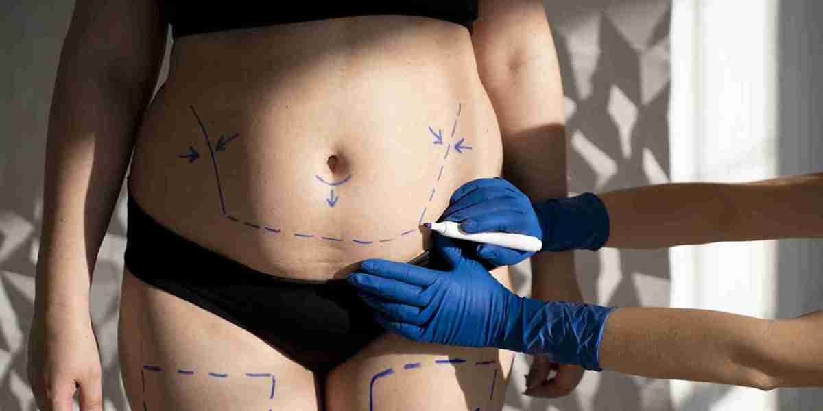 Plastic Surgery in Dubai: How to Find the Right Treatment for Your Needs