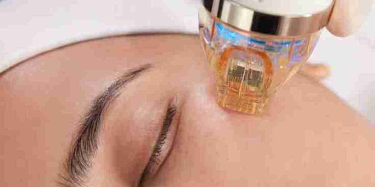Fractional RF Microneedling in Dubai: Safe Skin Care