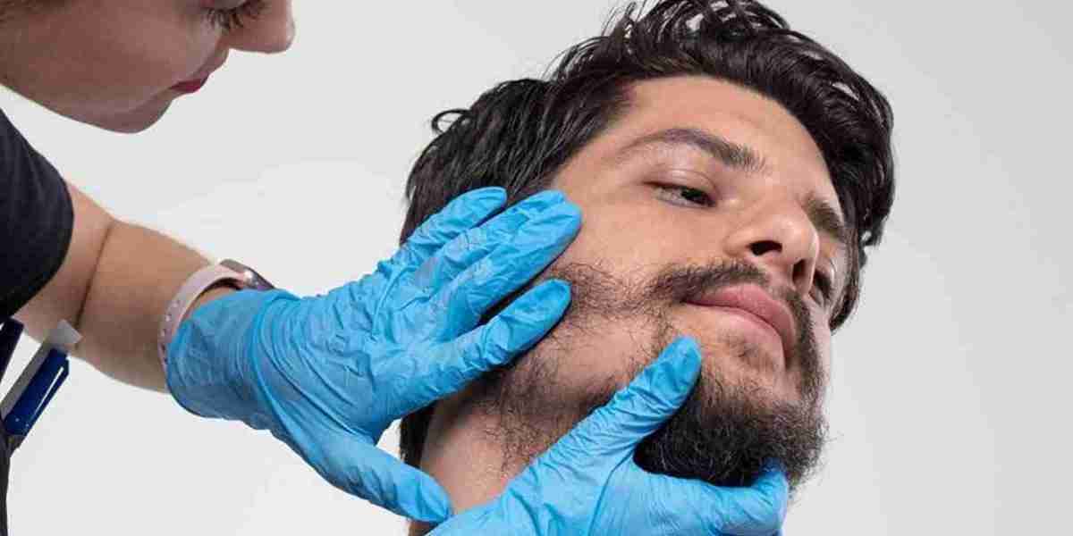 How Does Beard Hair Transplant in Islamabad Work? A Step-by-Step Guide