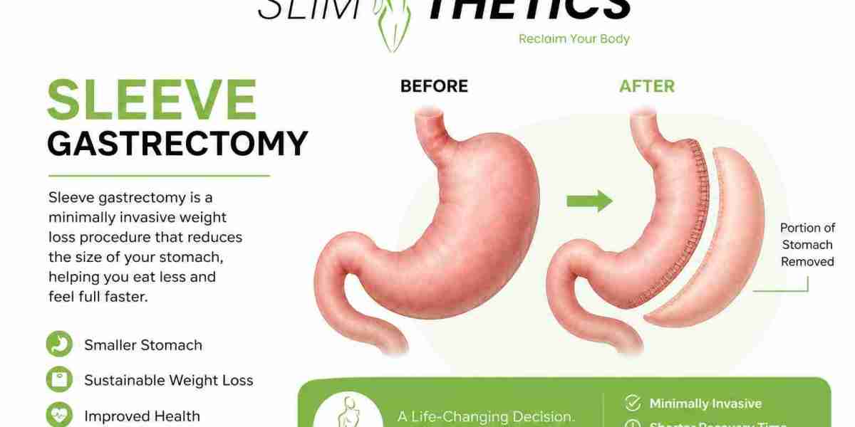 Pre-Operative Tests Required Before Sleeve Gastrectomy