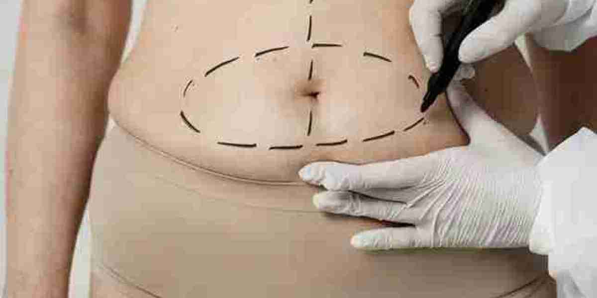 Questions to Ask Before Booking a Tummy Tuck in Dubai