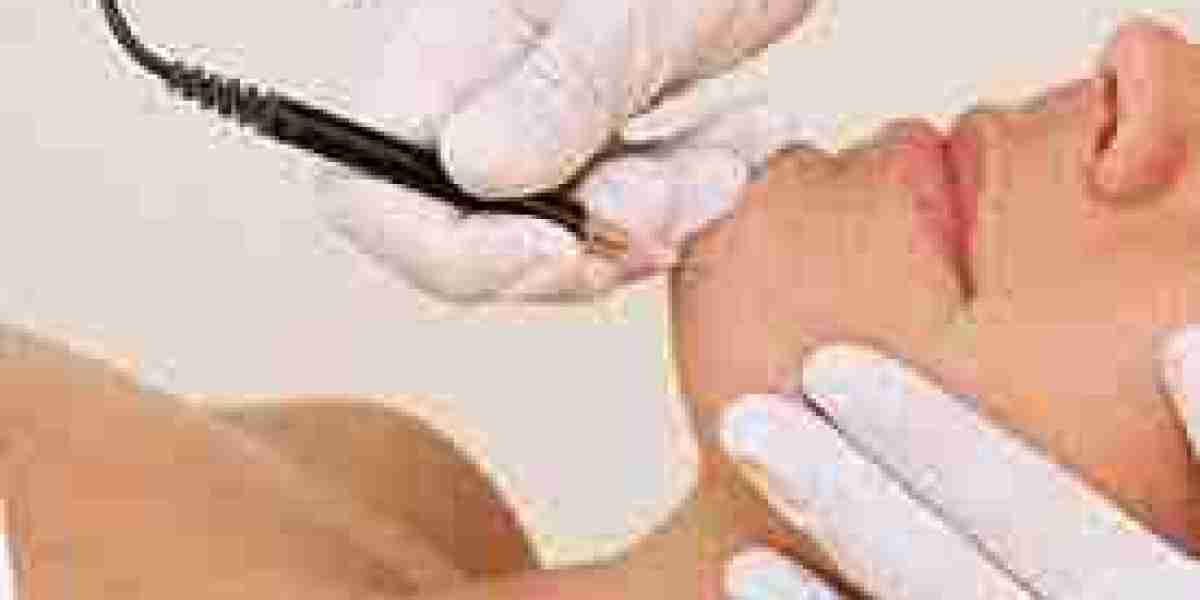 Electrolysis Hair Removal in Dubai for Different Hair Types